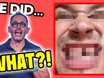 Dr. Luis Sanchez Reacts to the Viral $20 Veneers Video {{brizy_dc_image_alt entityId=