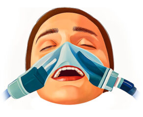 A patient wearing a Nitrous Oxide or Laughing Gas Mask at a Dental Office